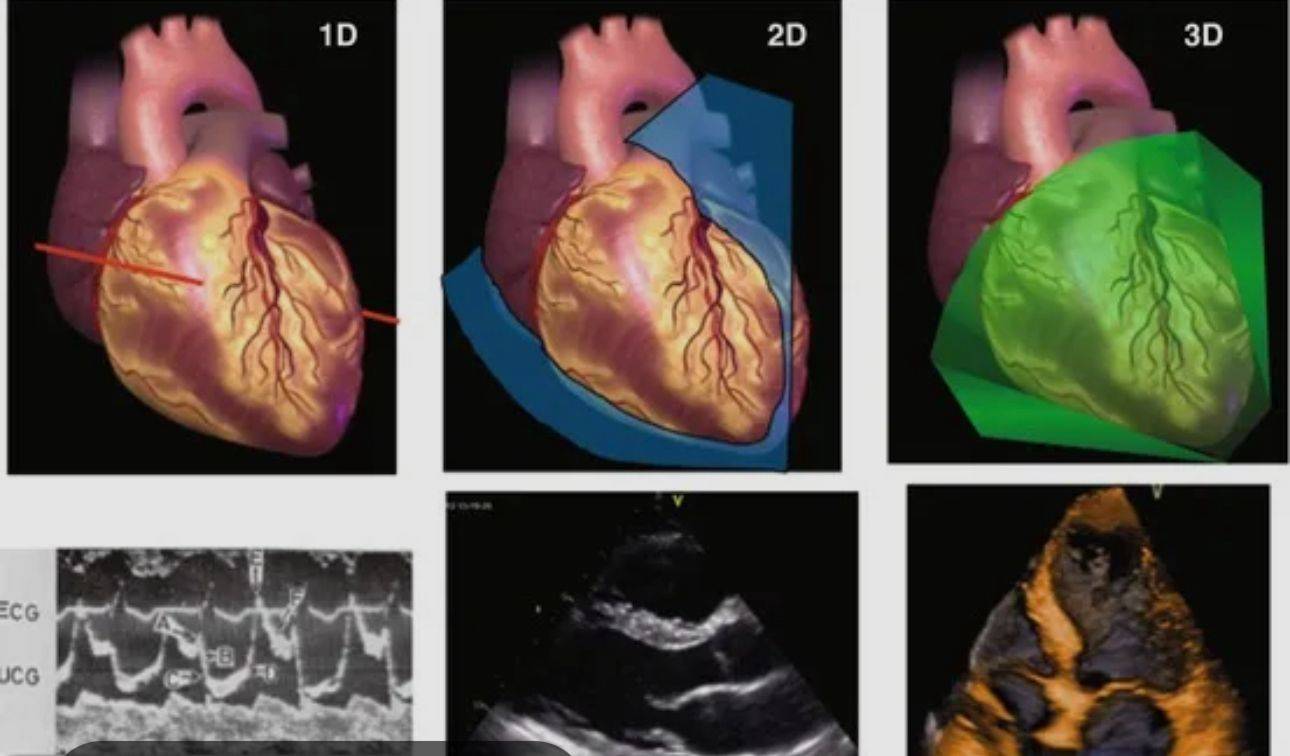 شيماء عبدالمعبود: الذكاء الاصطناعي يُحدث ثورة في تشخيص وعلاج أمراض القلب
