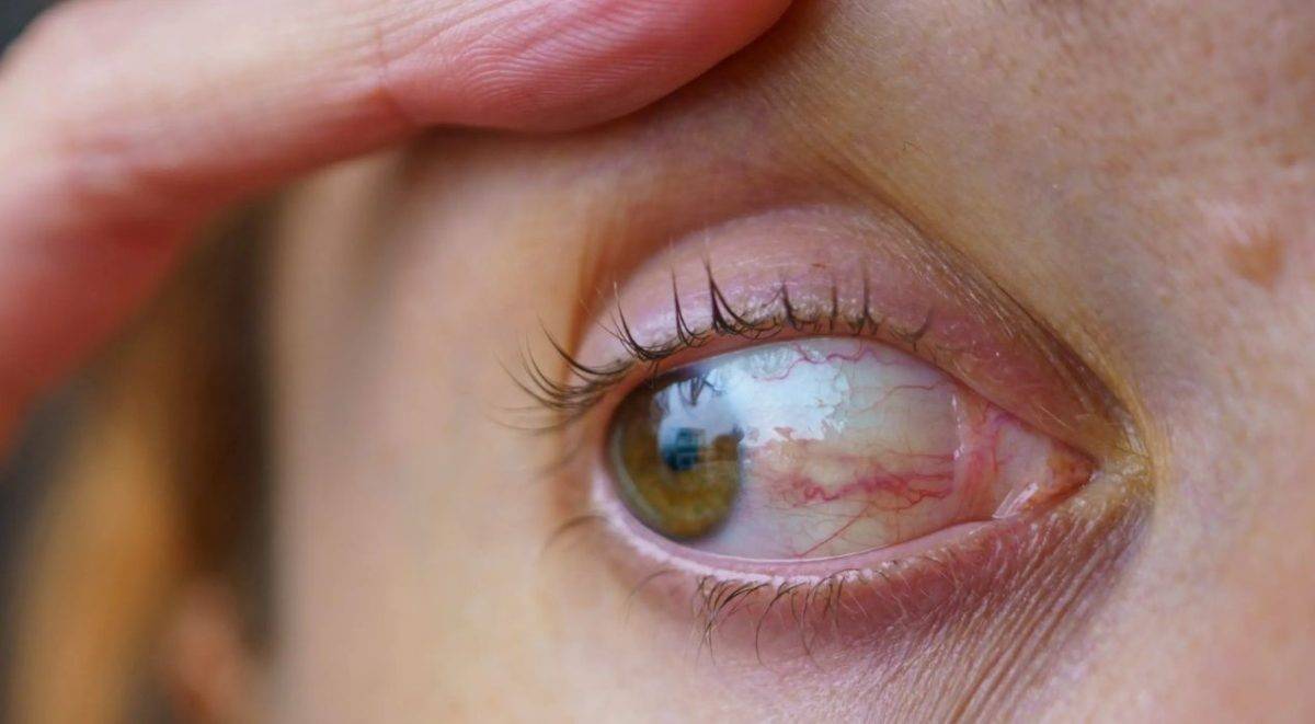 اضطرابات العين.. أعراض خطيرة قد تسبب فقدان البصر