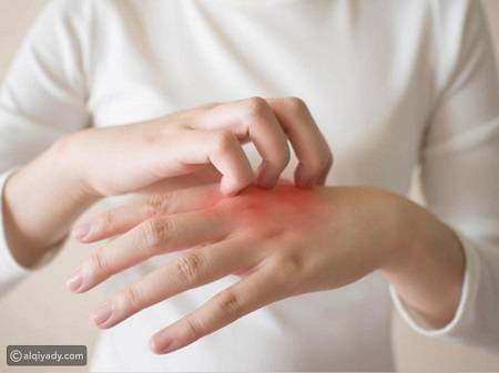 كيف تتجنب الطفح الجلدي وحروق الشمس في الصيف؟