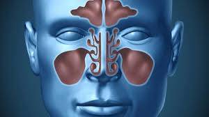 7 أعراض لالتهابات الجيوب الأنفية المزمنة.. منها آلام الأسنان