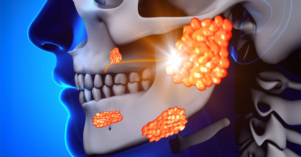 أبو كعب عند الأطفال.. كيف تكتشف النكاف مبكرًا وتتجنب مضاعفاته؟