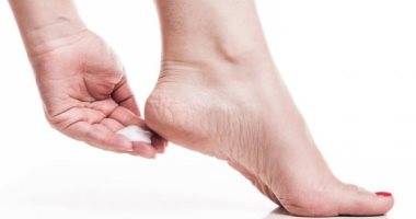 كيف أتخلص من مسمار القدم بفعالية في المنزل؟