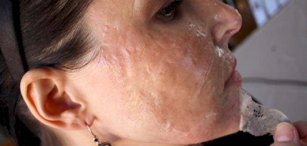 كيف أشد وجهي بطريقة طبيعية وآمنة؟ نصائح وماسكات طبيعية