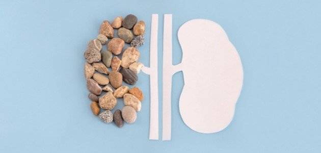 7 نصائح ذهبية لتخفيف آلام حصوات الكلى ومنع تكونها