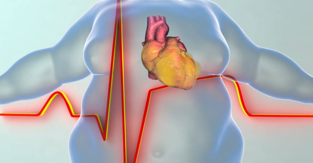 السمنة تهدد قلبك.. 4 مخاطر لا تتجاهلها