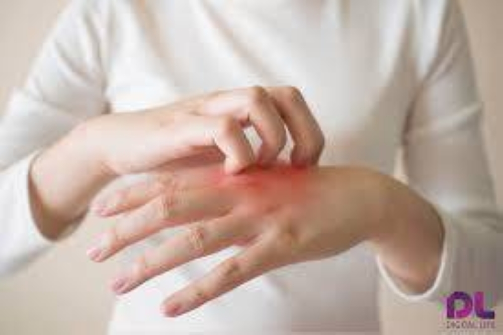 كيف تعرف أن جلدك بدأ يعاني من الحساسية؟ 6 إشارات واضحة