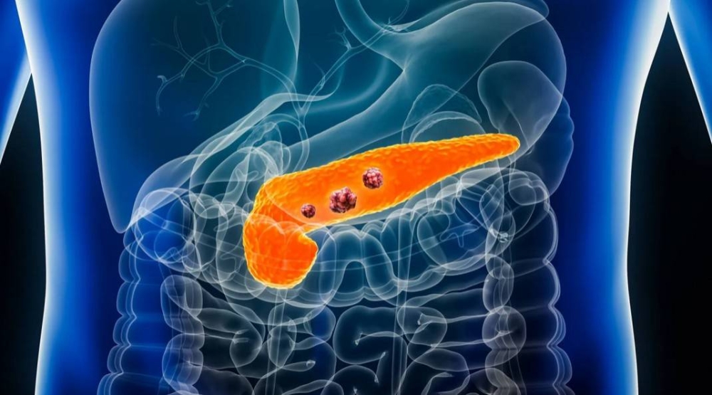 د. فيصل المحروس لـ&laquo;الوطن&raquo;: السكري يزيد خطر الإصابة بسرطانات عدة يتقدمها الثدي