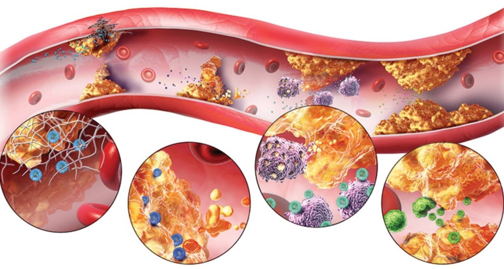 شيماء عبدالمعبود: التشخيص و&laquo;الكارديو&raquo;أساس الوقاية من أمراض القلب