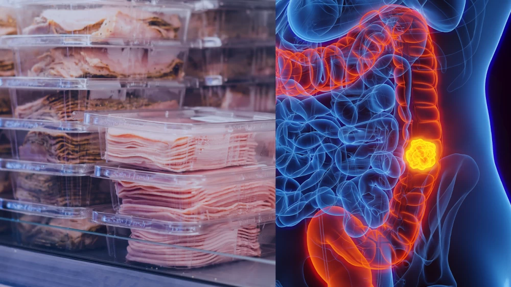 علماء بريطانيون يطالبون بوضع تحذيرات على لحم الخنزير لتسببه بسرطان القولون