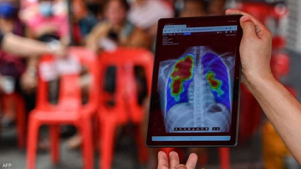 &laquo;الصحة العالمية&raquo;: وفاة أكثر من مليون شخص بالسل المعدي خلال العام الماضي