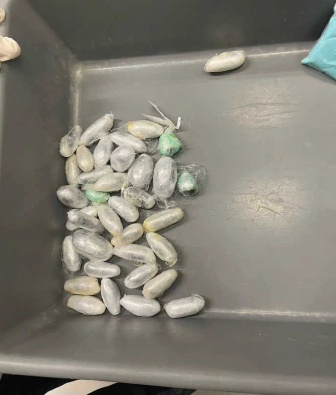 الكويت: إحباط تهريب مخدرات داخل أحشاء مسافر أوروبي قادم من لندن