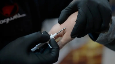 ساحر يفقد كلمة مرور شريحة زرعها داخل جسده لاستخدامها في الخدع