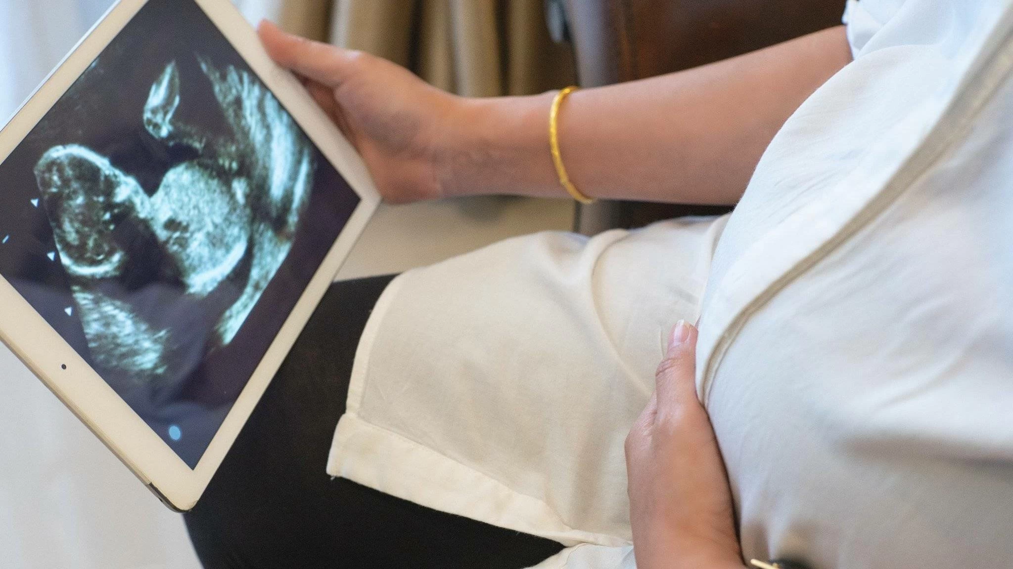 مدبولي لـ&laquo;الوطن&raquo;: الكلمة الأولى تصنع الفارق عند إبلاغ الأسرة بتشخيص متلازمة داون