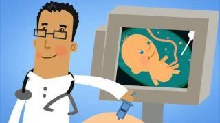 مدبولي لـ&laquo;الوطن&raquo;: الكلمة الأولى تصنع الفارق عند إبلاغ الأسرة بتشخيص متلازمة داون