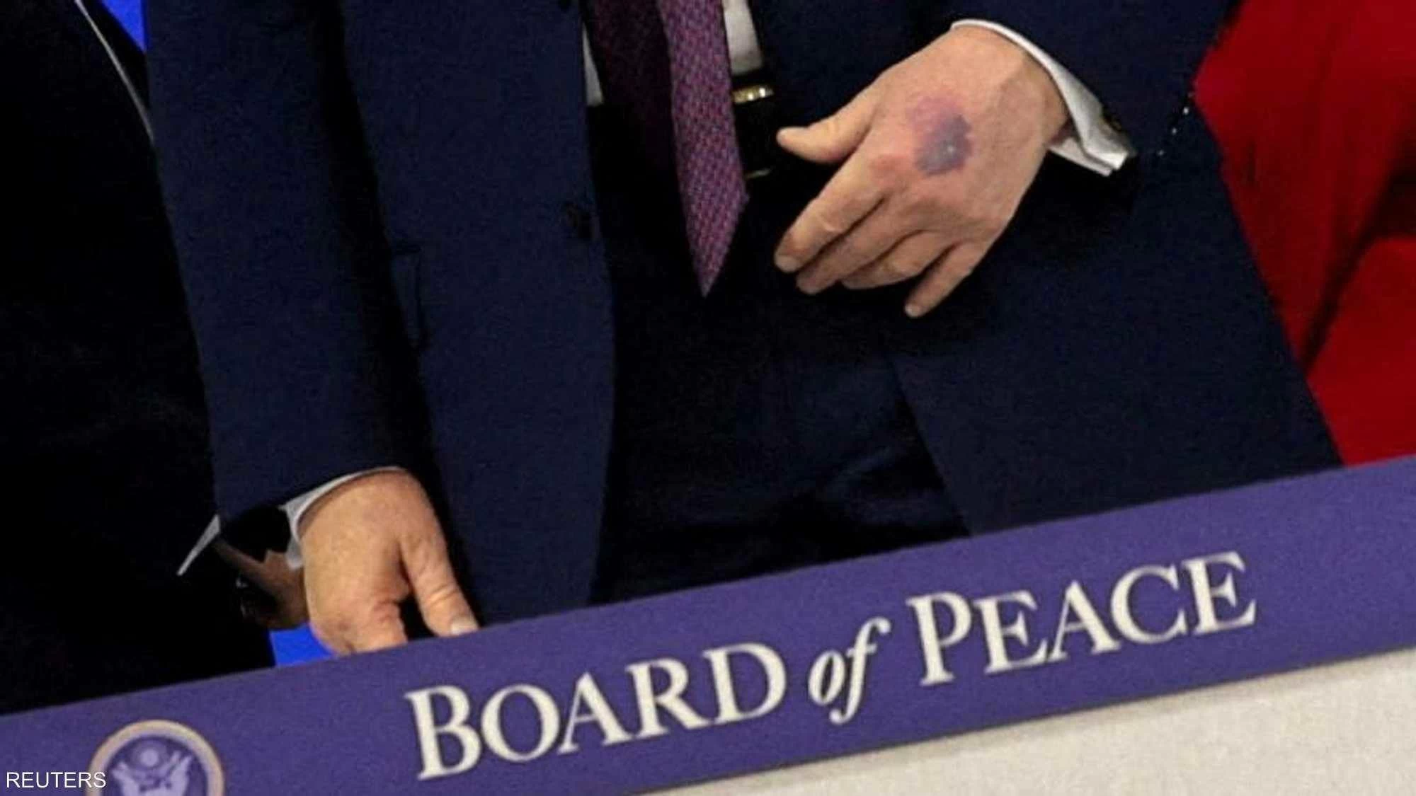 الطاولة أم المصافحة.. تضارب في رواية &laquo;كدمة ترامب&raquo;