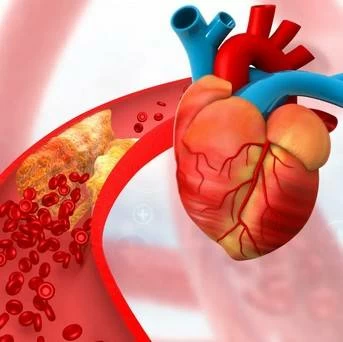 شيماء عبدالمعبود: متلازمة الأيض خطر صامت يرتبط بالسمنة وأمراض القلب