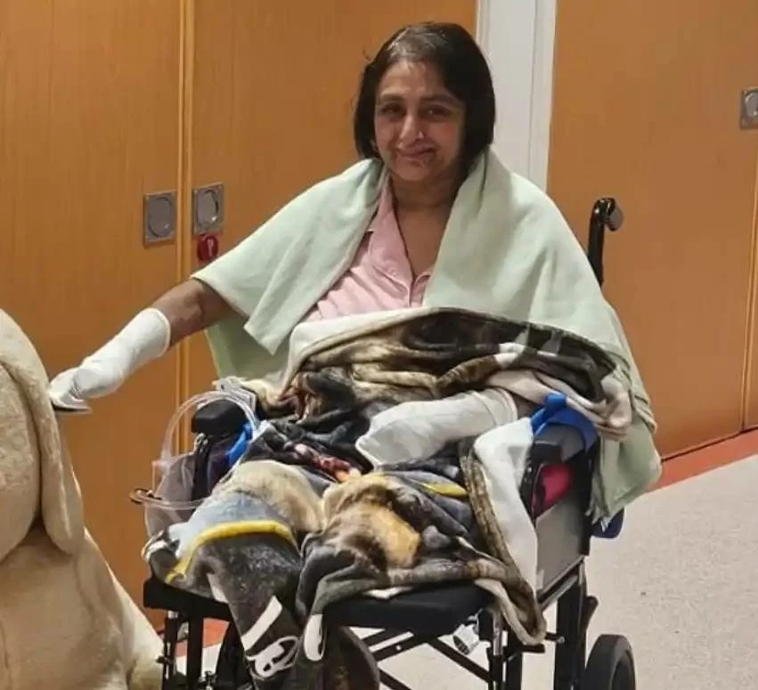 بسبب &laquo;لعقة كلب&raquo;.. امرأة تفقد أطرافها بتسمم نادر (صور)