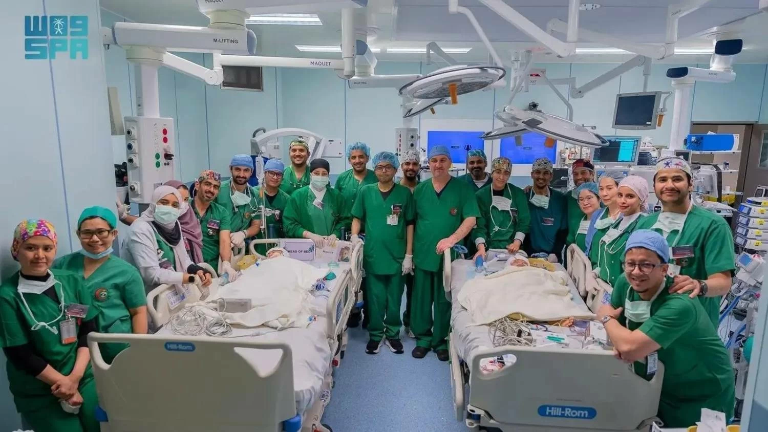 السعودية: نجاح فصل التوأم الملتصق الفلبيني بعد عملية جراحية معقدة 